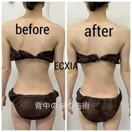 【背中対策集中メニュー!】背中のみオールハンドでマッサージ♡背中痛い方・猫背・肩凝りにオススメ!