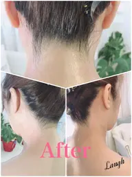 女性☆うなじwax脱毛☆モニター　※4/2より価格変更致します。1000→1500