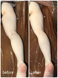 脚痩身エステ✨キャビテーション＋ラジオ波→マッサージ💕60分