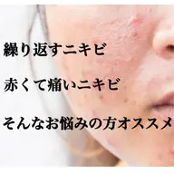 【ニキビ・肌荒れ】全顔毛穴洗浄+アクネ微弱電流導入+保湿パック+ミニモ限定保湿クリーム￥5500※クーポン内容確認