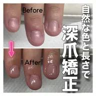 平日限定❤️🔥深爪矯正【長さ出し】◆カラーあり◆むしったり割れたり噛んで小さくなってしまった爪も美しく綺麗な状態に