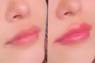 メラニンケア⭐️LALA PINKモニター(リップ)