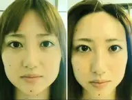 【フェイシャル】愛され 小顔♪フェイス リンパ インド マッサージ コース 90分