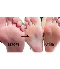 SNSで人気✨泡シャンフットケア🫧＋マッサージリフレ　モニター価格❣️期間限定