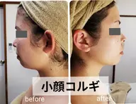 小顔コルギ(角質ケア、パック付き)