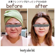 ミニモ限定メニュー🙆ツヤツヤもっちりになる水素美顔フェイシャル✨80分　身体すっきりデコルテマッサージ付き💫