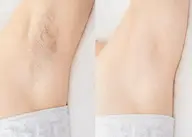 ワックス脱毛 【脇パーツ】