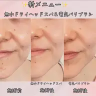 脳疲労回復！睡眠美容！無水ドライヘッドスパ（20分）＋電気バリブラシ（10分）（男性可能）