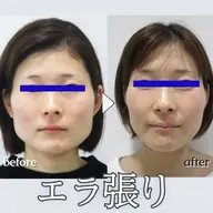 👑全国人気NO.1!👑【小顔矯正+美顔マッサージ】+【首肩矯正】💆 50分<顔やせ/エラ張り/首を長く細くなど>