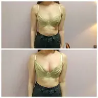 ♦︎ミニモ限定1000円OFF♦︎症例写真モニター(撮影必須)