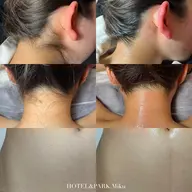 新生活に🎒【VIO+おへそ下+うなじワックス脱毛】