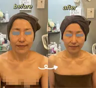 【最新7Dビューティー全顔10000ショット】新規価額15800円