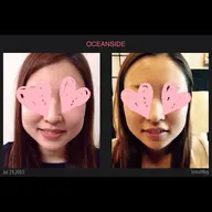 小顔最強セット✨5000円❗️驚愕の即効性や瞬間小顔❗️お試しください❤️