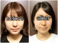 【当日OK🫧】即効むくみ小顔首肩リンパ×フェイスライン引き締め60分