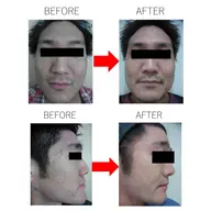 【男性限定】パーソナライズケア