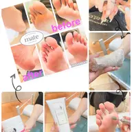 フット角質ケア (2回目以降割引有り)