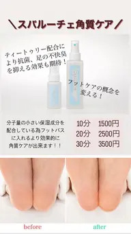 フット角質ケア10分(1500円)20分(2500円)30分(3500円)
