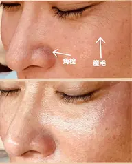 【フェイスワックス脱毛付き】整 -TOTONOE-（眉デザインフルコース）