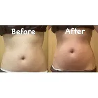 【即効性！腕or腹or腰】指定部位7D H I F U10000shot＋ハイパーナイフ15分