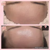 【ミニモREVIハーブピーリング】"ごわつきざらつき解消"通常価格¥11000→¥7500