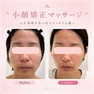 【60分】フェイスラインすっきり♪小顔マッサージ(胸元〜顔〜頭皮まで)※おひとり様1回限り