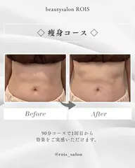 ✨痩身✨筋膜リペア 全身90分コース