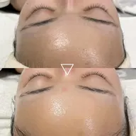 【ご新規様限定】【モニター】肌質改善フェイシャルエステ