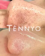 ミニモ限定！毛穴洗浄。専用美容液で優しく古い角質/角栓/皮脂などの汚れを取り除きます。化粧ノリ◎スキンケア浸透も◎