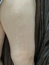 もみだし痩身　120分