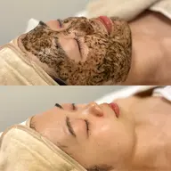 【4月🌸60%OFF★】5名様限定！韓国式ハーブピーリング