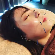 【ミニモ価格☆新規限定☆】美容針&美顔灸スペシャルコース　メンズok