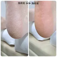 足裏角質ケア　ミニモ限定☆お試し価格