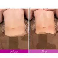 🔹🔹メンズ限定🔹🔹【お腹45分】（ハイパーナイフEX)🔹お腹のサイズダウンに🔹¥16500→¥9900