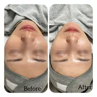 ✨すっぴんツヤ肌コース✨おすすめメニュー✨