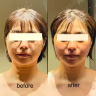 【整顔リセットマッサージ】当店人気小顔エステ✨【肩こり首凝りでお悩みの方も◎】シワ・たるみなどエイジングのお悩みにも♡