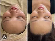 【オープン限定無料体験】毛穴洗浄+お好きなメニューおひとつ✨