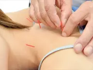 【鍼灸+整体+ストレッチ】90分おまかせコース