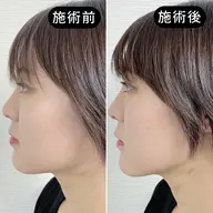 【迷ったらコレ】むくみ・左右差・肌悩みも当日相談OK