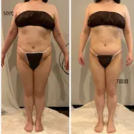 [お腹+二の腕+背中]ハイパーナイフEx+マッサージコース60分