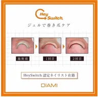 巻き爪ケア〔親指1本〕