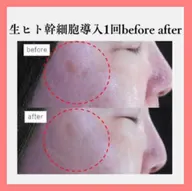 生ヒト幹細胞再生スペシャル