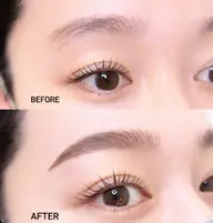 アイブローリフト