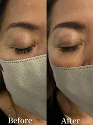 HBL(ハリウッドブロウリフト)4週間以内リピーター様