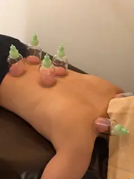 【新規限定1名様✨】快眠ドライへ ッドスパ+カッピング＋アロマリンパマッサージ90分 💐口コミ投稿頂ける方