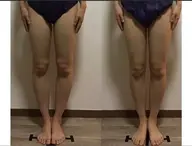 《下半身太りの方必見》ヒップUP•脚長効果•O脚改善も！