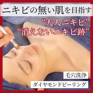 【本気のニキビケア】AI肌診断+ダイヤモンドピーリング+美容液導入+モチモチ美白パック★今だけ顔脱毛プレゼント中