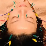 ヘッド&デコルテ立体造顔電流美容鍼　70分