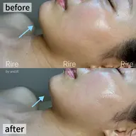 【緩んだ筋肉をググッと引き締め☆】リフトアップフェイシャル《プレミアム》