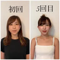 小顔モデル様募集♪4回(1回𝟓𝟓𝟎𝟎円)足から小顔矯正で姿勢も変わります✨リラックスしながら小顔にもなれる😌✨
