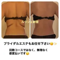 気になる部分集中✴︎🔥大量発汗🔥高周波&痩身揉み出し☆施術時間120分